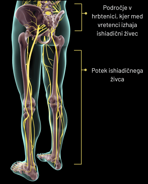 Anaotomski prikaz poteka ishiadičnega živca z označenimi področji